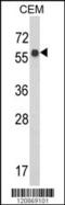 WD Repeat Domain 1 antibody, 61-597, ProSci, Western Blot image 