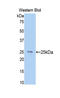 Alpha-N-Acetylgalactosaminidase antibody, LS-C295543, Lifespan Biosciences, Western Blot image 