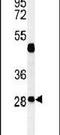 Ras Related GTP Binding D antibody, PA5-24881, Invitrogen Antibodies, Western Blot image 
