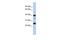 TMPO antibody, GTX46633, GeneTex, Western Blot image 