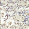 RuvB Like AAA ATPase 1 antibody, LS-C334243, Lifespan Biosciences, Immunohistochemistry paraffin image 