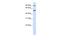 WD Repeat Domain 34 antibody, A10783, Boster Biological Technology, Western Blot image 