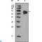 Fibroblast Growth Factor Receptor 4 antibody, LS-C812371, Lifespan Biosciences, Immunofluorescence image 