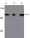 Component Of Inhibitor Of Nuclear Factor Kappa B Kinase Complex antibody, A01918T23, Boster Biological Technology, Western Blot image 
