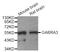 Gamma-Aminobutyric Acid Type A Receptor Alpha3 Subunit antibody, STJ29660, St John