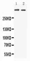 Huntingtin antibody, PA2268, Boster Biological Technology, Western Blot image 