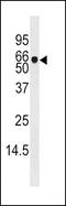 Adenosine Kinase antibody, PA5-13860, Invitrogen Antibodies, Western Blot image 