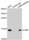 LSM4 Homolog, U6 Small Nuclear RNA And MRNA Degradation Associated antibody, LS-C334366, Lifespan Biosciences, Immunoprecipitation image 