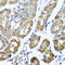 Hyaluronidase 1 antibody, A04099, Boster Biological Technology, Immunohistochemistry paraffin image 
