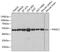 Proteasome 26S subunit ATPase 2 antibody, GTX54583, GeneTex, Western Blot image 