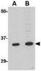 Growth Hormone Regulated TBC Protein 1 antibody, GTX31339, GeneTex, Western Blot image 