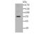 Insulin Like Growth Factor 2 MRNA Binding Protein 3 antibody, NBP2-76890, Novus Biologicals, Western Blot image 