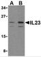 Interleukin 23 Subunit Alpha antibody, A01097-2, Boster Biological Technology, Western Blot image 