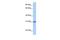 Chromosome 7 Open Reading Frame 61 antibody, GTX45433, GeneTex, Western Blot image 