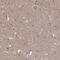 Rho GTPase Activating Protein 20 antibody, HPA038458, Atlas Antibodies, Immunohistochemistry paraffin image 