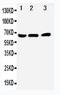 Nuclear Receptor Subfamily 4 Group A Member 1 antibody, PA1676, Boster Biological Technology, Western Blot image 