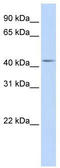 DENN Domain Containing 1B antibody, TA340372, Origene, Western Blot image 