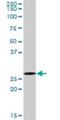 Proteasome Subunit Alpha 7 antibody, H00005688-D01P, Novus Biologicals, Western Blot image 