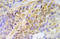 Checkpoint Kinase 2 antibody, AP20931PU-N, Origene, Immunohistochemistry frozen image 