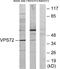 Vacuolar Protein Sorting 72 Homolog antibody, EKC1834, Boster Biological Technology, Western Blot image 