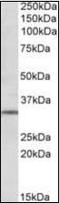 Glutamate Metabotropic Receptor 2 antibody, orb96439, Biorbyt, Western Blot image 