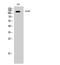 EPH Receptor B2 antibody, A01507-2, Boster Biological Technology, Western Blot image 