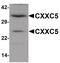 CXXC Finger Protein 5 antibody, PA5-21080, Invitrogen Antibodies, Western Blot image 