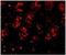 PHD Finger Protein 6 antibody, NB100-68261, Novus Biologicals, Immunofluorescence image 