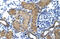 General Transcription Factor IIIC Subunit 5 antibody, 28-371, ProSci, Immunohistochemistry paraffin image 