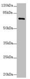 Collagen Beta(1-O)Galactosyltransferase 2 antibody, CSB-PA818260LA01HU, Cusabio, Western Blot image 