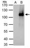 Elongator Acetyltransferase Complex Subunit 2 antibody, NBP2-16321, Novus Biologicals, Immunoprecipitation image 