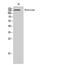 Neurocan antibody, STJ94429, St John