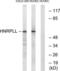 Heterogeneous Nuclear Ribonucleoprotein L Like antibody, LS-C120037, Lifespan Biosciences, Western Blot image 