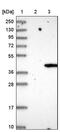 Lysophosphatidylglycerol Acyltransferase 1 antibody, PA5-52541, Invitrogen Antibodies, Western Blot image 