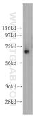 Tripeptidyl Peptidase 1 antibody, 12479-1-AP, Proteintech Group, Western Blot image 