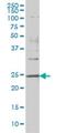 Distal-Less Homeobox 1 antibody, H00001745-M01, Novus Biologicals, Western Blot image 