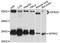 GDNF Family Receptor Alpha 2 antibody, A2954, ABclonal Technology, Western Blot image 