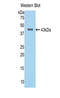 Complement Factor B antibody, LS-C304659, Lifespan Biosciences, Western Blot image 