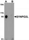 Synaptopodin 2 Like antibody, TA320023, Origene, Western Blot image 