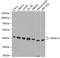 Proteasome 26S Subunit, Non-ATPase 13 antibody, 22-586, ProSci, Western Blot image 