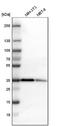 Twinfilin Actin Binding Protein 1 antibody, NBP1-90297, Novus Biologicals, Western Blot image 