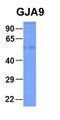 Potassium Voltage-Gated Channel Interacting Protein 2 antibody, orb324609, Biorbyt, Western Blot image 