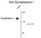 Synaptojanin 1 antibody, GTX82587, GeneTex, Western Blot image 