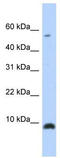 C-X-C Motif Chemokine Ligand 6 antibody, TA329198, Origene, Western Blot image 
