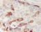 Cyclin B1 antibody, M00745-3, Boster Biological Technology, Immunohistochemistry paraffin image 