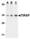 TIR Domain Containing Adaptor Protein antibody, orb108976, Biorbyt, Western Blot image 