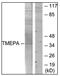 Prostate Transmembrane Protein, Androgen Induced 1 antibody, AP31759PU-N, Origene, Western Blot image 