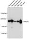 Amyloid-like protein 2 antibody, GTX33014, GeneTex, Western Blot image 