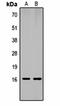 Histone Cluster 1 H1 Family Member A antibody, orb334656, Biorbyt, Western Blot image 