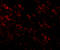 Amyloid Beta Precursor Protein antibody, 5129, ProSci Inc, Immunofluorescence image 